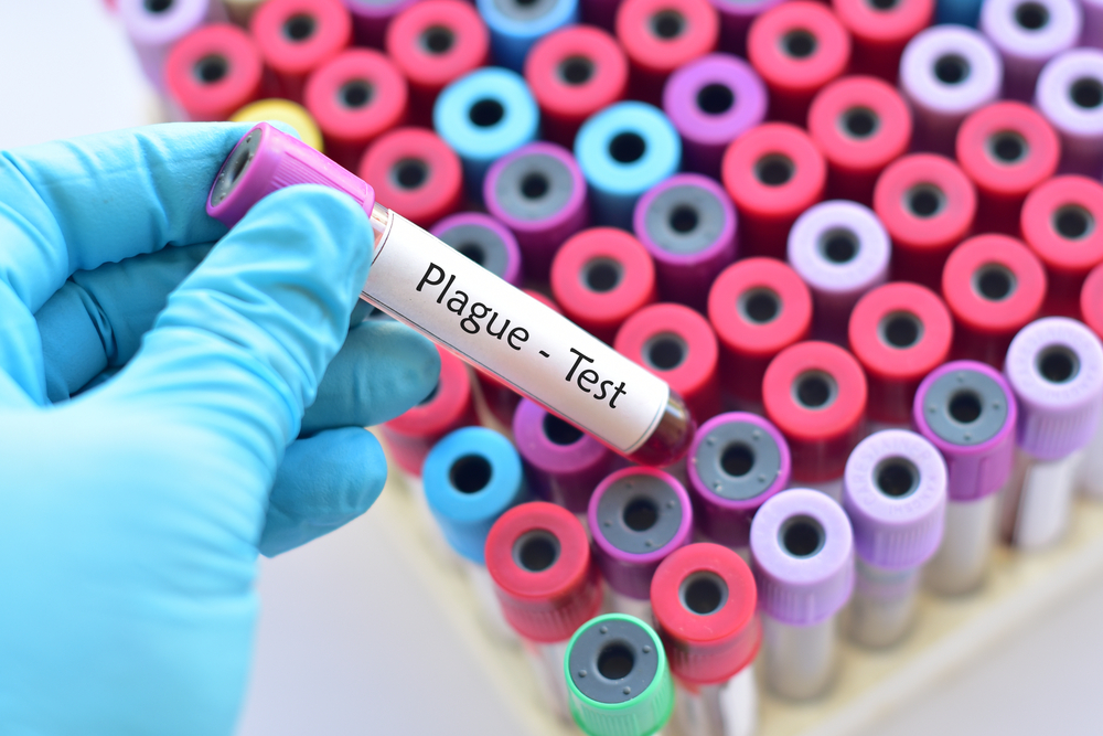 Doctor holding up a plague test tube.