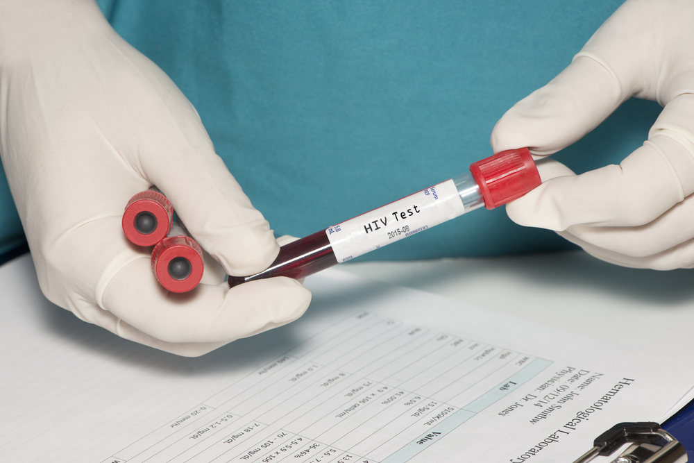 Doctor holding up HIV/AIDS test tube.